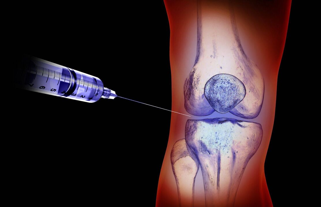 intraarticular injections maka arthrosis