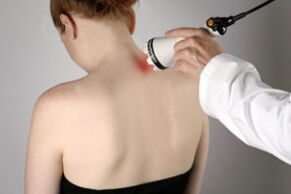 Laser na-agwọ ọrịa